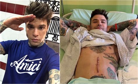 Fedez illness wikipedia